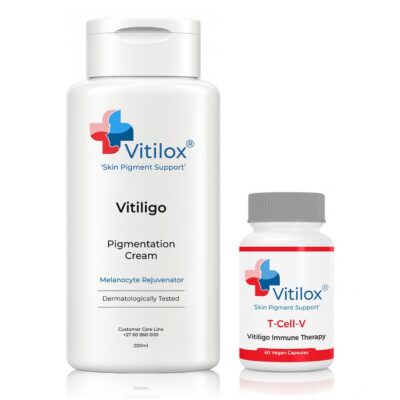 The Vitilox® Pigmentation Cream works directly on the affected skin to stimulate repigmentation - Vitilox for Vitiligo Treatment Pigmentation cream and vitamins