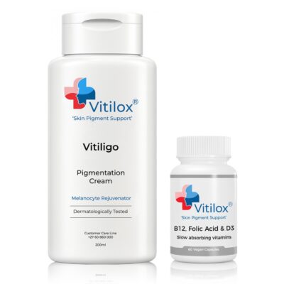 vitilox-cream-vitamins-vitiligo-treatment-1 - Vitilox for Vitiligo Treatment Vitilox Pigmentation Cream and Vitamins